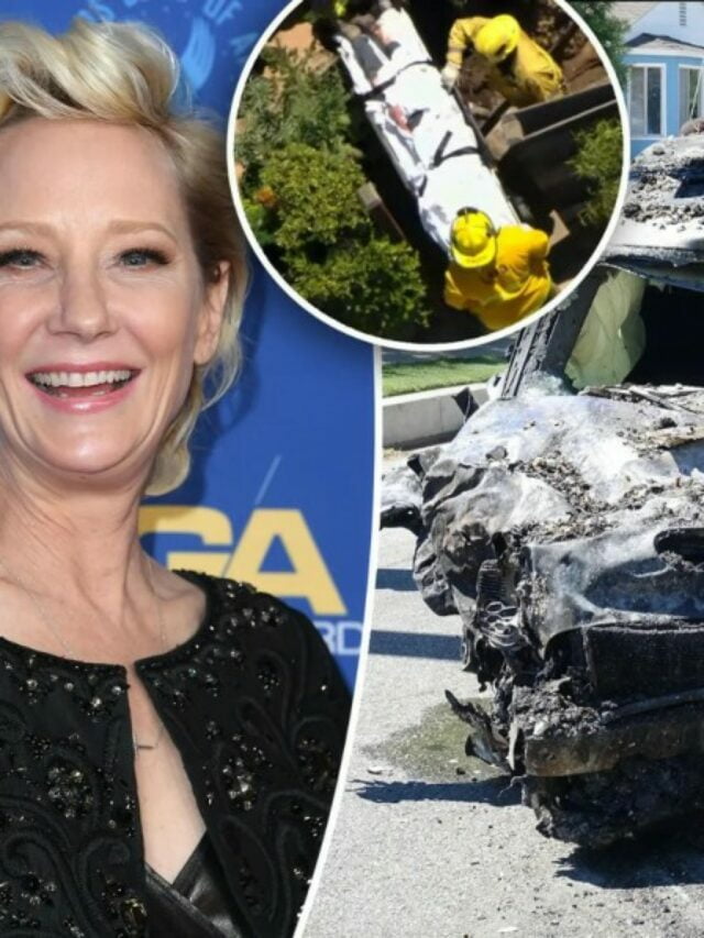 Anne Heche is in “extreme critical condition” on Friday